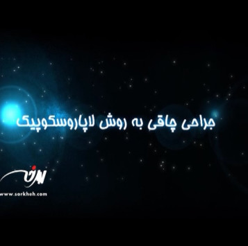 تیزر تبلیغاتی دکتر طاها عنبرا